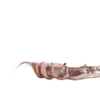 Gouttière transparente d’alignement dentaire, vue de profil.